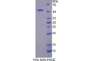Image no. 1 for Platelet-Activating Factor Acetylhydrolase 2, 40kDa (PAFAH2) (AA 1-392) protein (His tag) (ABIN6236813) (PAFAH2 Protein (AA 1-392) (His tag))