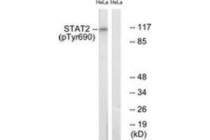 Western blot analysis of extracts from HeLa cells treated with IFN 2500U/ml 30', using STAT2 (Phospho-Tyr690) Antibody. (STAT2 抗体  (pTyr690))