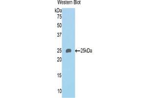 Western blot analysis of the recombinant protein. (SEMA4B 抗体  (AA 31-240))