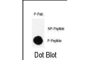 Dot blot analysis of Phospho-CRK-S41 polyclonal antibody (ABIN389702 and ABIN2837929) on nitrocellulose membrane. (Crk 抗体  (pSer41))