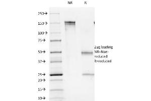 SDS-PAGE Analysis Purified CD1b Mouse Monoclonal Antibody (100-1A5). (CD1b 抗体)