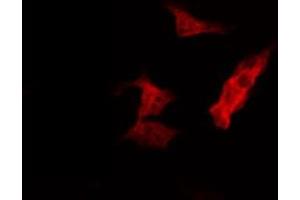 ABIN6274405 staining HepG2 by IF/ICC. (MARK2 抗体  (Internal Region))
