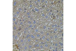 Immunohistochemistry of paraffin-embedded mouse liver using VEGFC antibody (ABIN5971381) (40x lens).