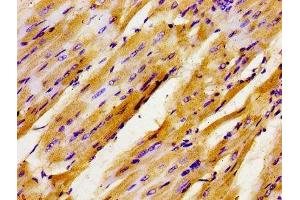 Immunohistochemistry (IHC) image for anti-General Transcription Factor II I Repeat Domain-Containing 1 (GTF2IRD1) (AA 436-560) antibody (ABIN7153789)