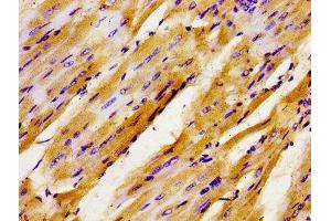 Immunohistochemistry of paraffin-embedded human heart tissue using ABIN7153789 at dilution of 1:100 (GTF2IRD1 抗体  (AA 436-560))