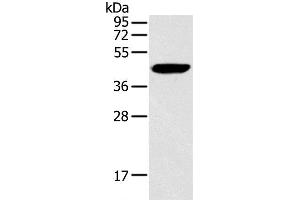 Western Blot analysis of Hela cell using RAD51 Polyclonal Antibody at dilution of 1:200 (RAD51 抗体)