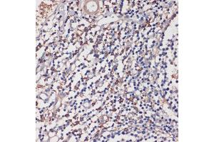 Immunohistochemistry of paraffin-embedded human tonsil using TLR5 antibody (ABIN3022438, ABIN3022439, ABIN3022440 and ABIN6218820) at dilution of 1:100 (40x lens). (TLR5 抗体  (AA 714-858))