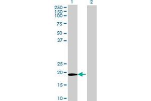 Western Blot analysis of ZFAND1 expression in transfected 293T cell line by ZFAND1 MaxPab polyclonal antibody. (ZFAND1 抗体  (AA 1-161))