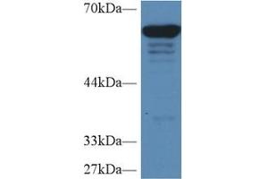 Detection of PKM2 in Human HepG2 cell lysate using Polyclonal Antibody to Pyruvate kinase isozymes M2 (PKM2) (PKM2 抗体  (AA 141-248))
