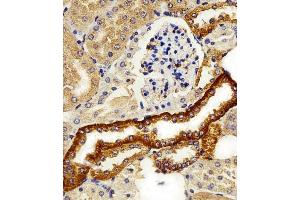 Immunohistochemical analysis of paraffin-embedded M. (FXYD6 抗体  (C-Term))