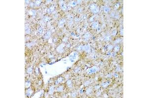 Immunohistochemistry of paraffin-embedded rat brain using PTGDS antibody. (PTGDS 抗体)