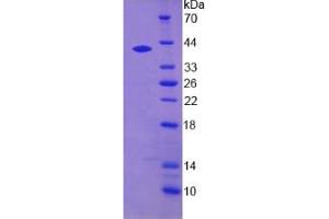 SDS-PAGE analysis of Human DTNBP1 Protein. (DTNBP1 蛋白)