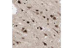 Immunohistochemical staining of human cerebral cortex with FBXO44 polyclonal antibody  shows strong nuclear and cytoplasmic positivity in neuronal cells at 1:200-1:500 dilution. (FBXO44 抗体)