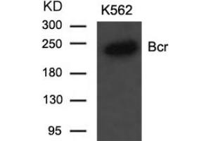 Image no. 2 for anti-Breakpoint Cluster Region (BCR) (Tyr177) antibody (ABIN197420) (BCR 抗体  (Tyr177))