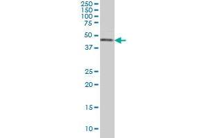 CSNK1G1 monoclonal antibody (M02), clone 2E10 Western Blot analysis of CSNK1G1 expression in Hela S3 NE . (CSNK1G1 抗体  (AA 293-393))