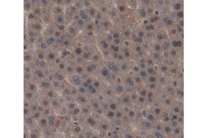 IHC-P analysis of liver tissue, with DAB staining. (NR1I3 抗体  (AA 1-247))