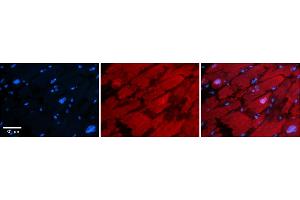 Rabbit Anti-HDAC6 Antibody    Formalin Fixed Paraffin Embedded Tissue: Human Adult heart  Observed Staining: Cytoplasmic,Nuclear Primary Antibody Concentration: 1:600 Secondary Antibody: Donkey anti-Rabbit-Cy2/3 Secondary Antibody Concentration: 1:200 Magnification: 20X Exposure Time: 0. (HDAC6 抗体  (N-Term))