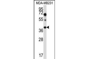 PTPLA Antibody (N-term) (ABIN657409 and ABIN2846449) western blot analysis in MDA-M cell line lysates (35 μg/lane). (PTPLA 抗体  (N-Term))