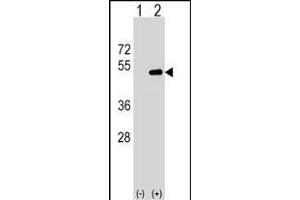 Western blot analysis of FNTA (arrow) using rabbit polyclonal FNTA Antibody (N-term) (ABIN1539445 and ABIN2849550). (FNTA 抗体  (N-Term))