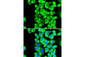 Immunofluorescence analysis of MCF-7 cells using RPS3A antibody (ABIN5973489). (RPS3A 抗体)