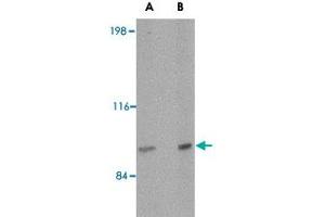 Western blot analysis of SATB2 in mouse brain tissue lysate with SATB2 polyclonal antibody  at (A) 2 and (B) 4 ug/mL . (SATB2 抗体  (N-Term))