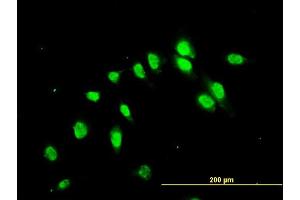 Immunofluorescence of monoclonal antibody to C17orf75 on HeLa cell. (C17orf75 抗体  (AA 1-396))