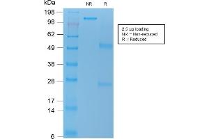 SDS-PAGE Analysis Purified VEGI Mouse Recombinant Monoclonal Antibody (rVEGI /1283). (Recombinant TNFSF15 抗体)