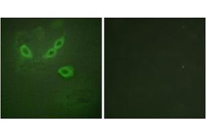 Immunofluorescence analysis of HeLa cells, using TUSC5 antibody. (TUSC5 抗体  (N-Term))