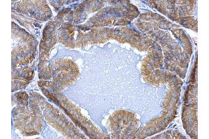 Immunohistochemistry (IHC) image for anti-Endoplasmic Reticulum Protein 29 (ERP29) antibody (ABIN2855330)
