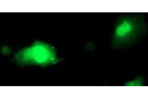 Anti-PDXK mouse monoclonal antibody (ABIN2454646) immunofluorescent staining of COS7 cells transiently transfected by pCMV6-ENTRY PDXK (RC200975). (PDXK 抗体)