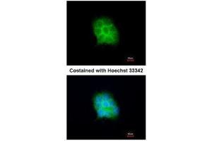 ICC/IF Image Immunofluorescence analysis of methanol-fixed A431, using Amisyn, antibody at 1:200 dilution. (STXBP6 抗体  (N-Term))