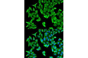 Immunofluorescence analysis of HeLa cells using PSMD9 antibody (ABIN5973093). (PSMD9 抗体)