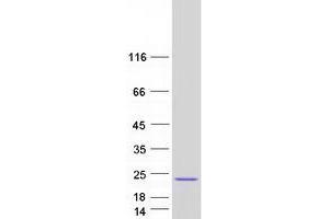 Western Blotting (WB) image for Eukaryotic Translation Initiation Factor 5A (EIF5A) (Transcript Variant D) protein (Myc-DYKDDDDK Tag) (ABIN2720109)