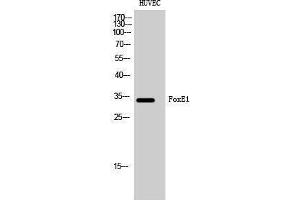 Western Blotting (WB) image for anti-Forkhead Box E1 (Thyroid Transcription Factor 2) (FOXE1) (N-Term) antibody (ABIN3184656)