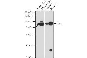 Western blot analysis of extracts of various cell lines, using IL1R1 antibody (ABIN6134083, ABIN6142341, ABIN6142342 and ABIN6221393) at 1:1000 dilution. (IL1R1 抗体)