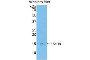 Western Blotting (WB) image for anti-Thymic Stromal Lymphopoietin (TSLP) (AA 75-196) antibody (ABIN1174486) (Thymic Stromal Lymphopoietin 抗体  (AA 75-196))