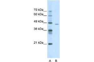 WB Suggested Anti-ACCN4 Antibody Titration:  0. (ACCN4 抗体  (N-Term))