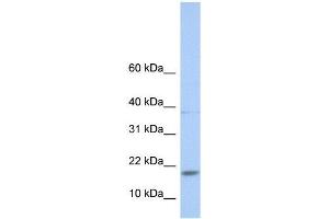 Western Blot showing MAX antibody used at a concentration of 1-2 ug/ml to detect its target protein. (MAX 抗体  (N-Term))