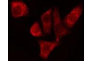 ABIN6274956 staining Hela cells by IF/ICC. (CA1 抗体  (Internal Region))