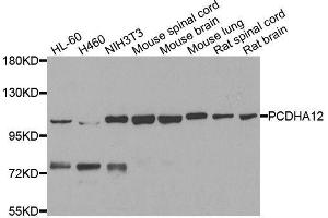 Western blot analysis of extracts of various cell lines, using PCDHA12 antibody. (PCDHA12 抗体  (AA 713-792))