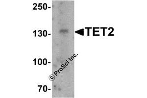 Western Blotting (WB) image for anti-Tet Methylcytosine Dioxygenase 2 (TET2) (N-Term) antibody (ABIN1031611) (TET2 抗体  (N-Term))