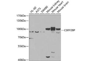 Western blot analysis of extracts of various cell lines, using CSRP2BP antibody (ABIN6127664, ABIN6139138, ABIN6139139 and ABIN6223242) at 1:1000 dilution. (CSRP2BP 抗体  (AA 523-782))