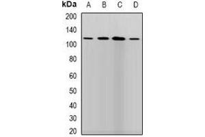 Western blot analysis of LLH expression in SKOV3 (A), HepG2 (B), mouse brain (C), mouse liver (D) whole cell lysates. (PLOD1 抗体)