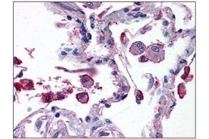 Human Lung: Formalin-Fixed, Paraffin-Embedded (FFPE) (TRIM7 抗体  (C-Term))