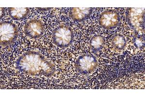 Immunohistochemistry (IHC) image for anti-Interleukin 4 Receptor (IL4R) (AA 26-232) antibody (ABIN7434557)