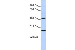 Western Blotting (WB) image for anti-Glutathione S-Transferase mu 5 (GSTM5) antibody (ABIN2459201) (GSTM5 抗体)