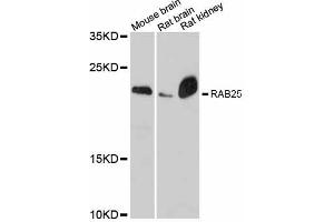 Western blot analysis of extracts of various cell lines, using RAB25 antibody (ABIN6290827) at 1:3000 dilution. (RAB25 抗体)