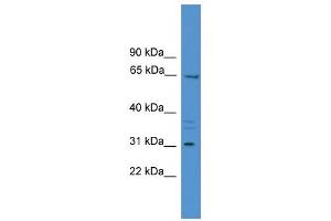 WB Suggested Anti-MEPE Antibody Titration:  0. (MEPE 抗体  (Middle Region))
