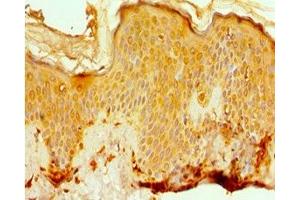 Immunohistochemistry of paraffin-embedded human skin tissue using ABIN7142077 at dilution of 1:100 (EFTUD2 抗体  (AA 1-205))