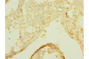 Immunohistochemistry (IHC) image for anti-Solute Carrier Organic Anion Transporter Family, Member 2B1 (SLCO2B1) (AA 130-210) antibody (ABIN7170303)
